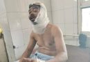 प्रेमिका ने प्रेमी पर किया कैंची से हमला